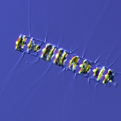 Microscopic Plankton