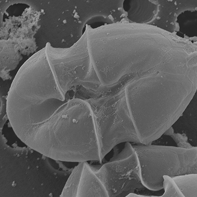 Microscopic Plankton