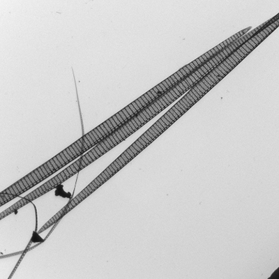 Microscopic Plankton